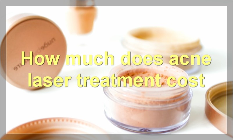 How much does acne laser treatment cost