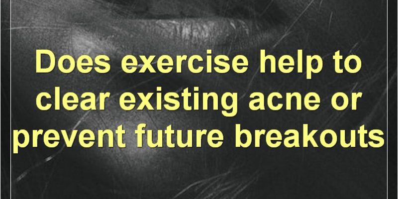 Exercise And Acne: The Complete Guide