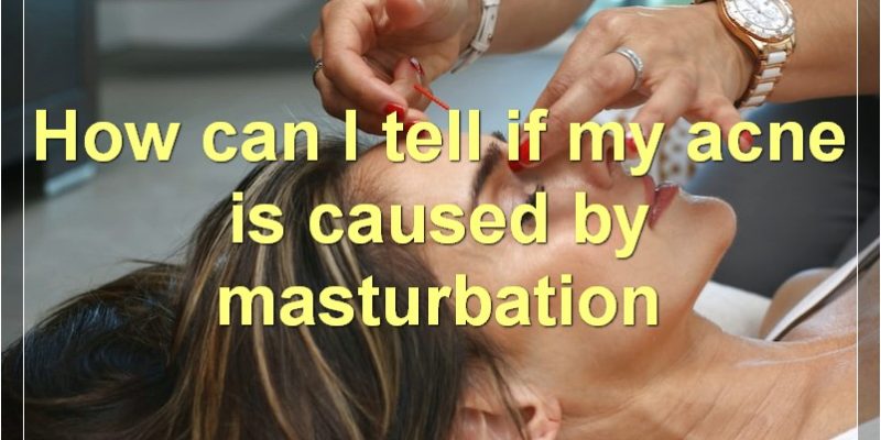 Masturbation And Acne: Everything You Need To Know