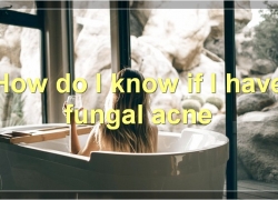 How To Deal With Fungal Acne