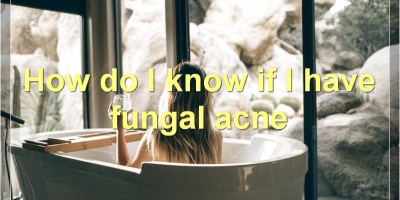 How To Deal With Fungal Acne