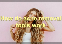 The Best Acne Removal Tools: How They Work And What To Know