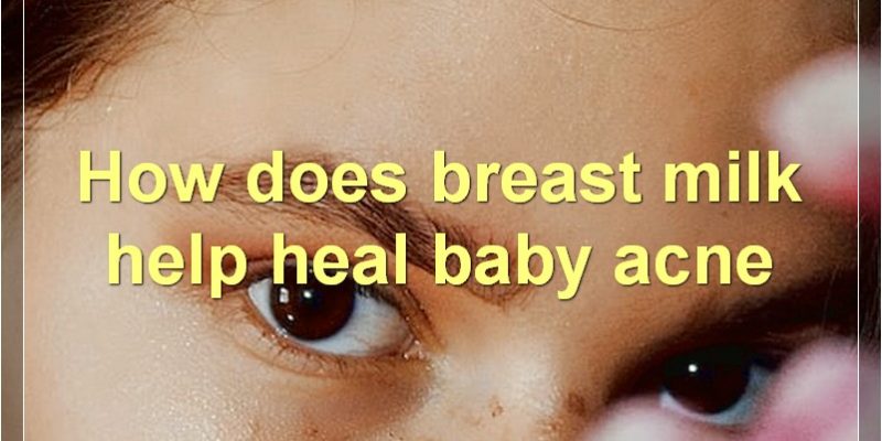 The Benefits Of Breast Milk For Baby Acne