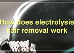 All You Need To Know About Electrolysis Hair Removal