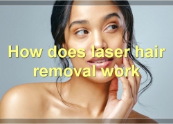 Laser Hair Removal: Everything You Need To Know