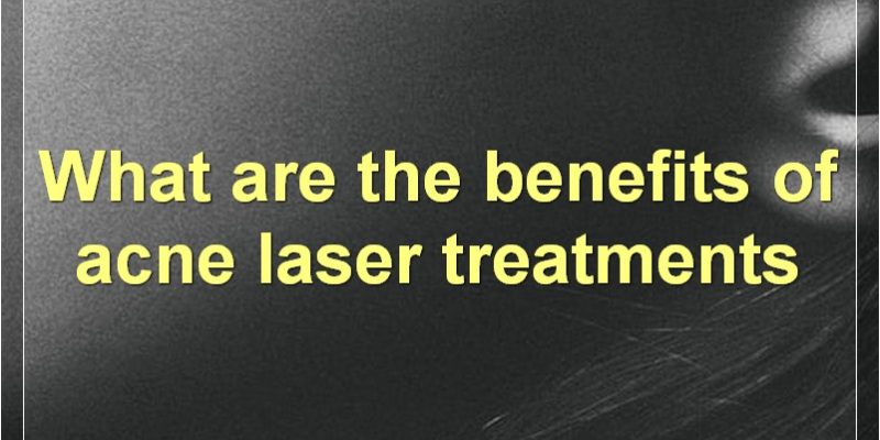 Acne Laser Treatment: Everything You Need To Know