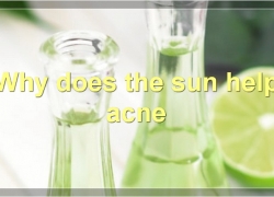 How Does The Sun Help Acne?